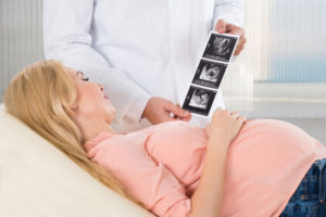 Eine Frau lässt sich von einem Arzt Ihre Ergebnisse der Ultraschalluntersuchung erklären.